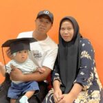 Andra Family - Right Plagiocephaly (very severe)