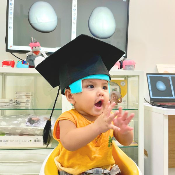 Baby Ipi (Cyril) - Moderate Combination Brachycephaly & Left Plagiocephaly