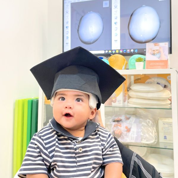 Baby Sandyakala - Severe Right Plagiocephaly
