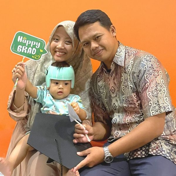 Mizan Family - Right Combo (Mild Brachycephaly and Very severe Right Plagiocephaly)
